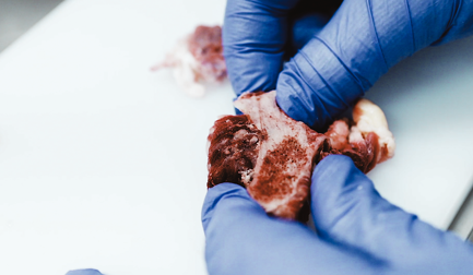 Como a inspeção por raio-X pode proteger e valorizar sua marca